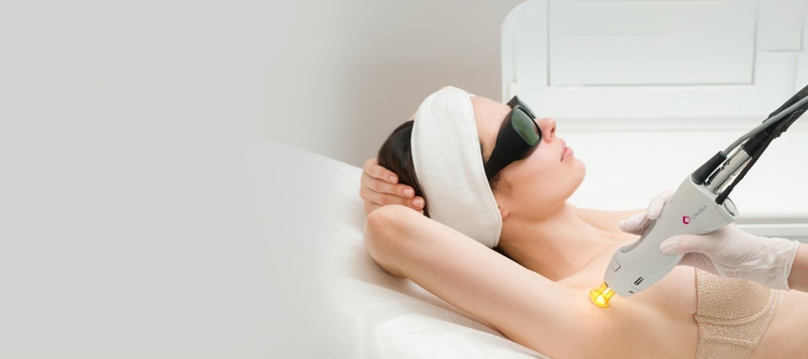 laser hair removal